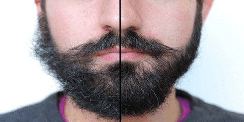 beard growing tips